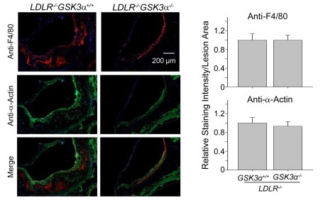 Representative images of cross sections of the aortic sinus from Ldlr-Gsk3a mice.jpg